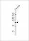 (DANRE) tmem208 Antibody (Center)